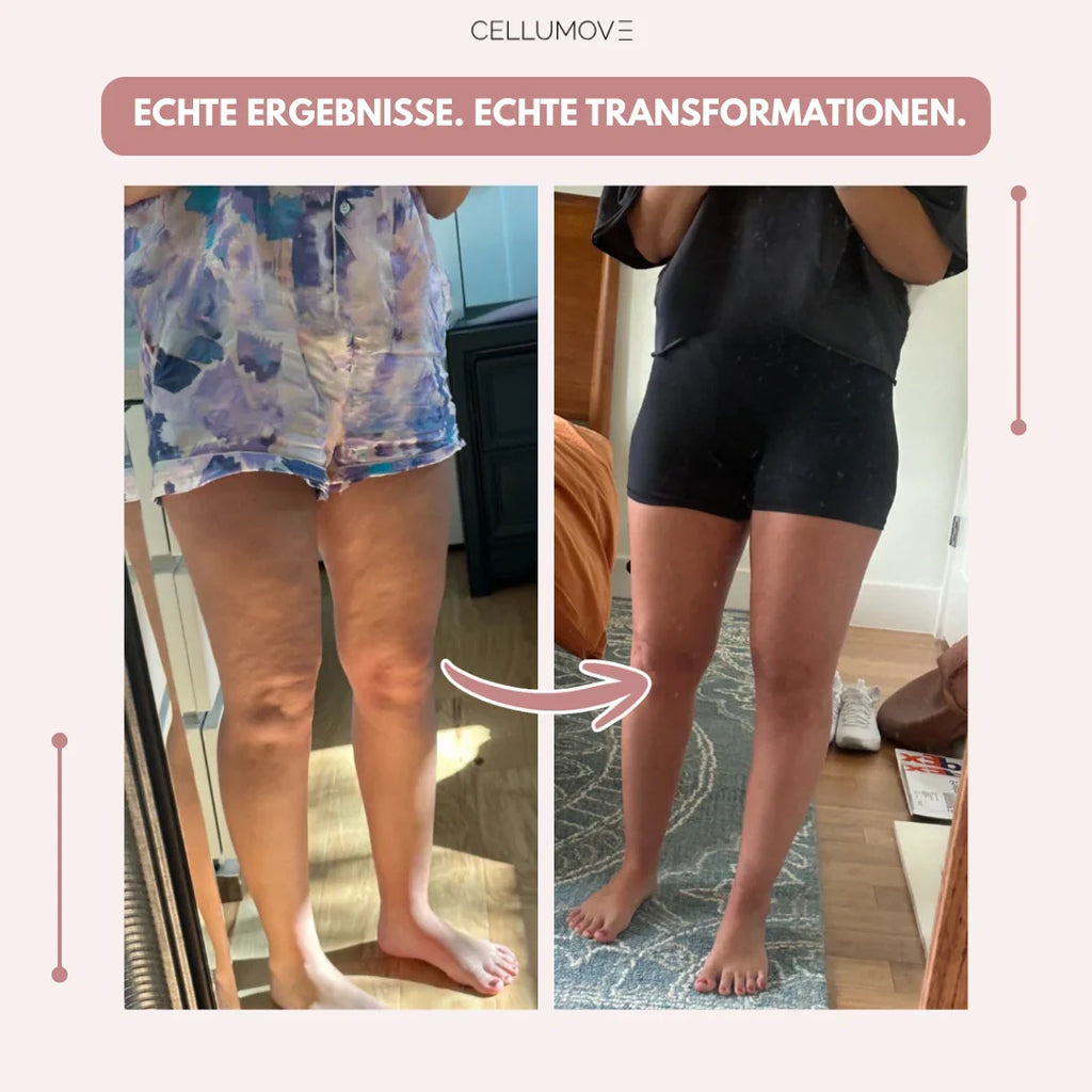 Celumove™ 3D Legging – Neem op natuurlijke wijze afscheid van pijnlijke en zware benen