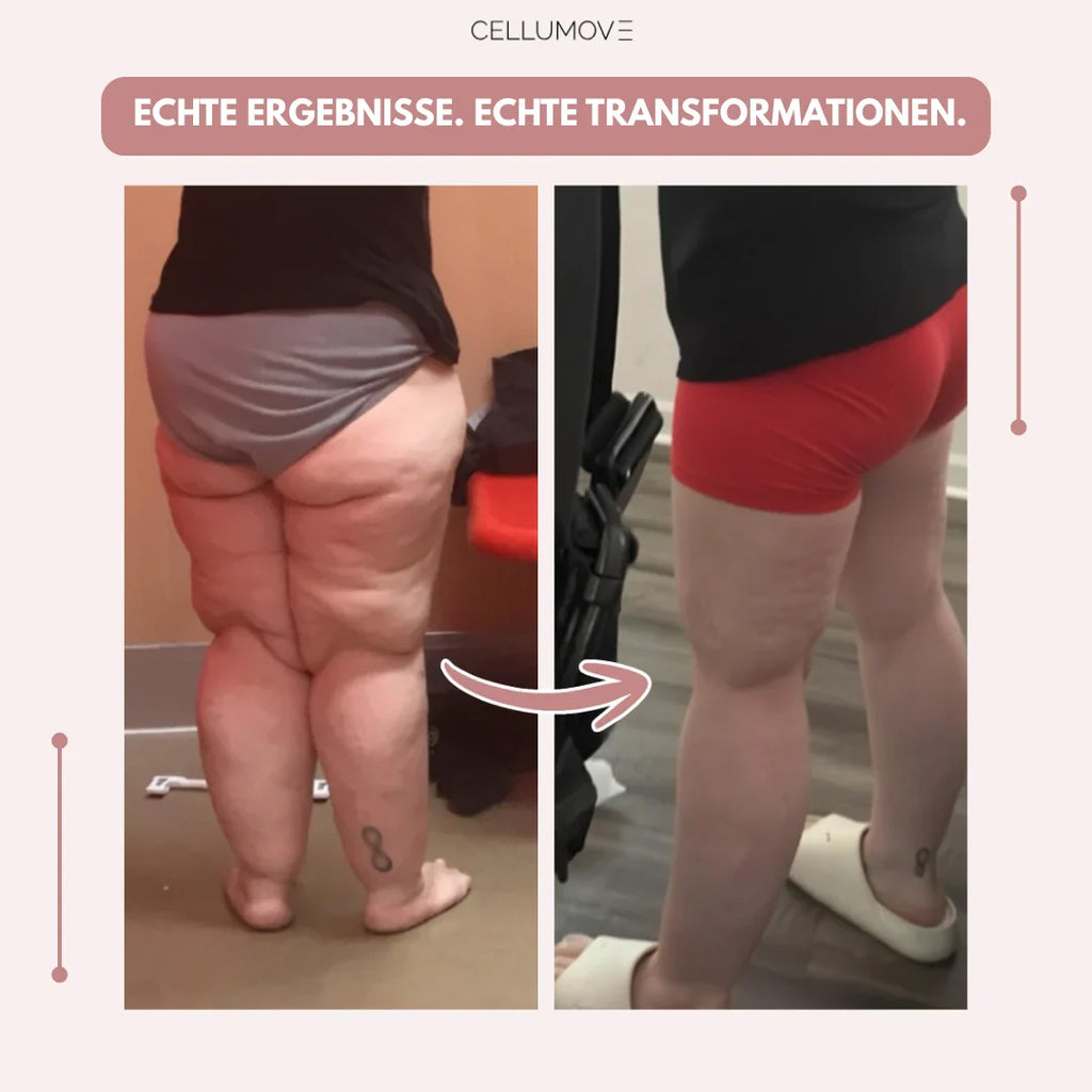 Celumove™ 3D Legging – Neem op natuurlijke wijze afscheid van pijnlijke en zware benen