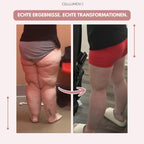 Celumove™ 3D Legging – Neem op natuurlijke wijze afscheid van pijnlijke en zware benen