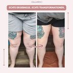Celumove™ 3D Legging – Neem op natuurlijke wijze afscheid van pijnlijke en zware benen