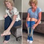 MaxRelive™ - Compressiekousen voor verlichting
